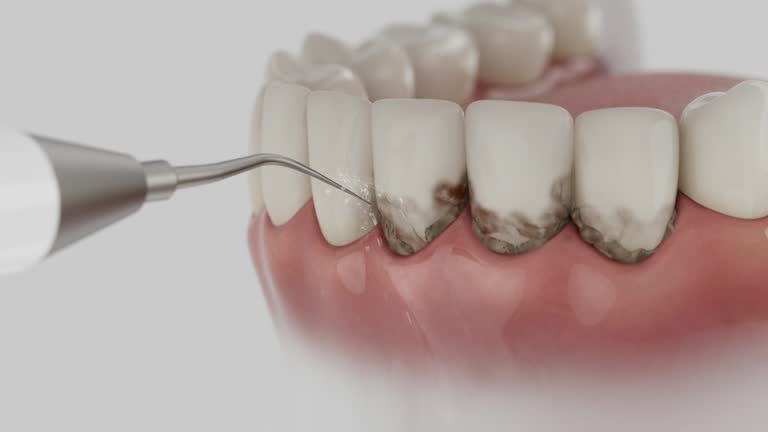 Trusted Root Canal Treatment service in Humble, TX - Dentist Open Now